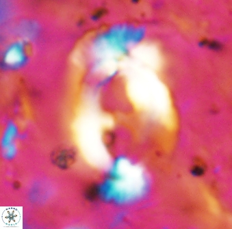 Helicosphaera mediterranea 27775