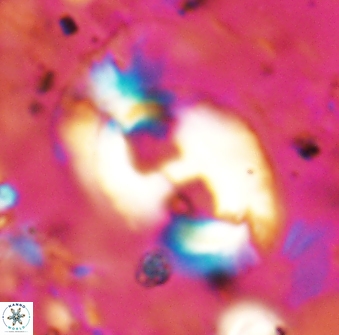 Helicosphaera mediterranea 27776