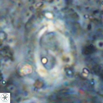 Helicosphaera mediterranea 27780