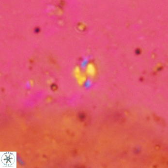 Helicosphaera minima 2426
