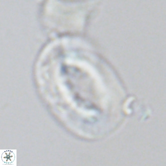 Helicosphaera neocrenulata VR 03542