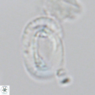 Helicosphaera neocrenulata VR 03543