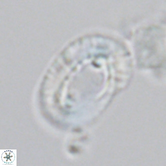 Helicosphaera neocrenulata VR 03544