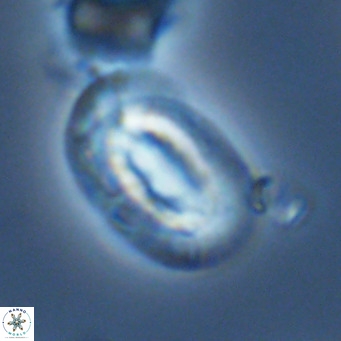 Helicosphaera neocrenulata VR 03546