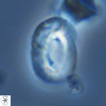 Helicosphaera neocrenulata VR 03547