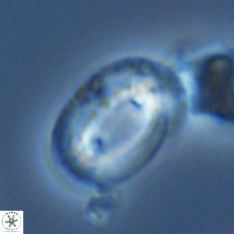 Helicosphaera neocrenulata VR 03548