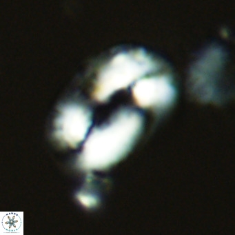 Helicosphaera neocrenulata VR 03539