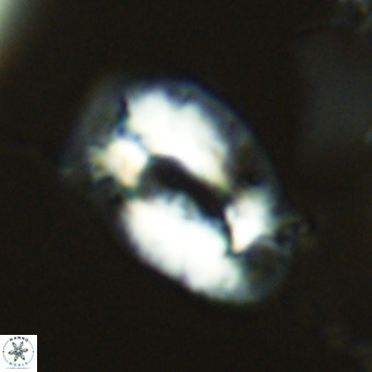 Helicosphaera neogranulata VR 03453
