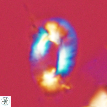 Helicosphaera neogranulata VR 03456