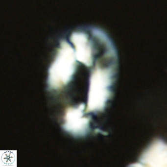 Helicosphaera neogranulata VR 03457