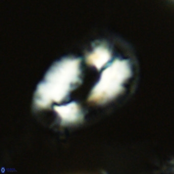 Helicosphaera neogranulata VR 03458