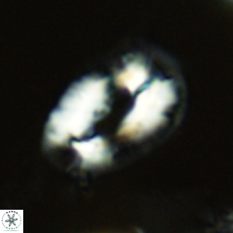 Helicosphaera neogranulata VR 03458