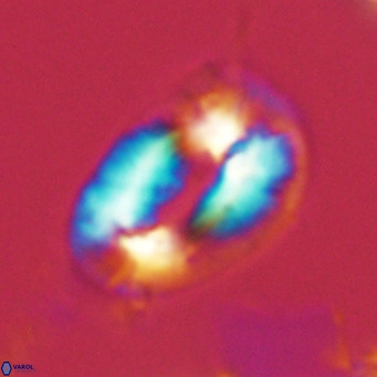 Helicosphaera neogranulata VR 03459