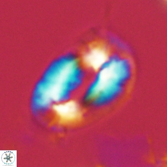 Helicosphaera neogranulata VR 03459