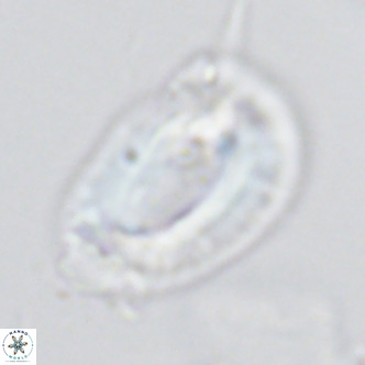 Helicosphaera neogranulata VR 03460