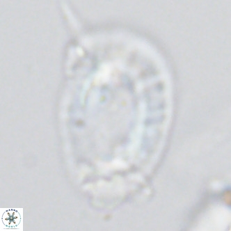Helicosphaera neogranulata VR 03461