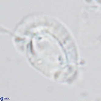 Helicosphaera neogranulata VR 03462