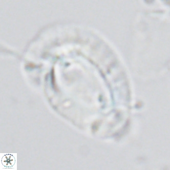 Helicosphaera neogranulata VR 03462