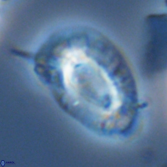 Helicosphaera neogranulata VR 03463