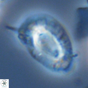Helicosphaera neogranulata VR 03463