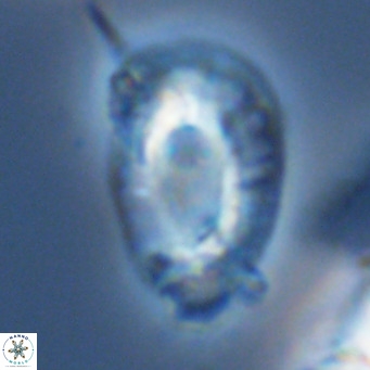 Helicosphaera neogranulata VR 03464