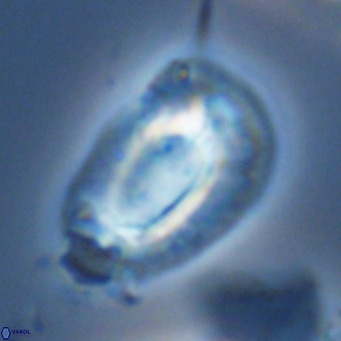 Helicosphaera neogranulata VR 03465