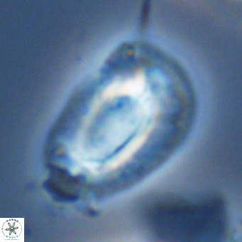 Helicosphaera neogranulata VR 03465