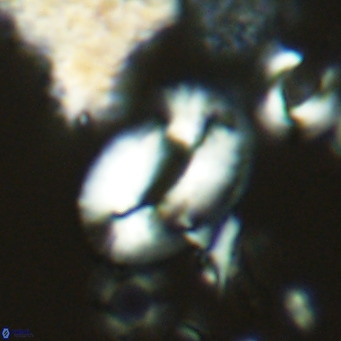 Helicosphaera neogranulata VR 04084