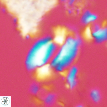 Helicosphaera neogranulata VR 04085