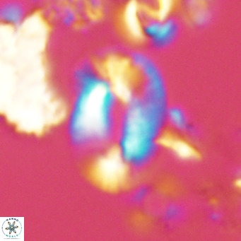 Helicosphaera neogranulata VR 04086