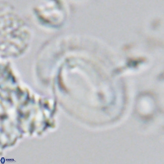 Helicosphaera neogranulata VR 04090