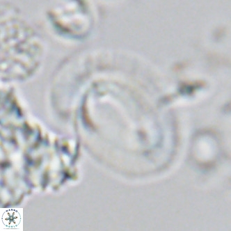 Helicosphaera neogranulata VR 04090
