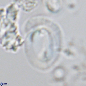 Helicosphaera neogranulata VR 04092