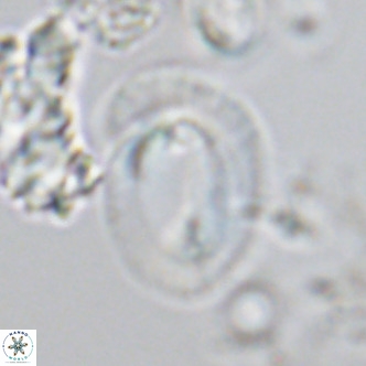 Helicosphaera neogranulata VR 04092
