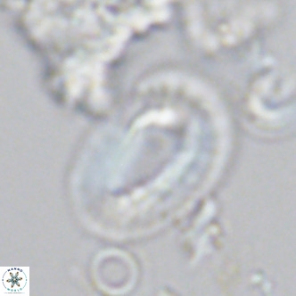 Helicosphaera neogranulata VR 04094