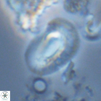 Helicosphaera neogranulata VR 04096