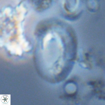 Helicosphaera neogranulata VR 04097