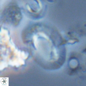 Helicosphaera neogranulata VR 04098