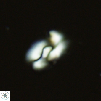 Helicosphaera neointermedia VR 05540