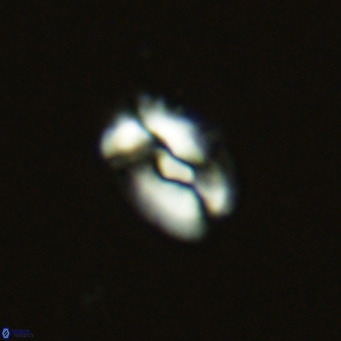 Helicosphaera neointermedia VR 05541