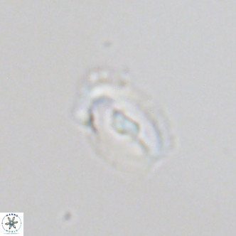 Helicosphaera neointermedia VR 05543