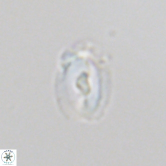 Helicosphaera neointermedia VR 05547