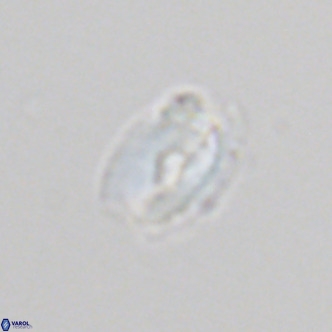 Helicosphaera neointermedia VR 05549