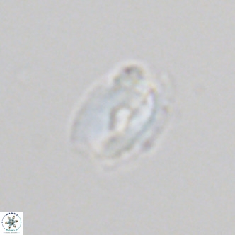 Helicosphaera neointermedia VR 05549