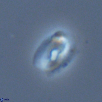 Helicosphaera neointermedia VR 05550