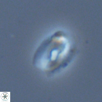 Helicosphaera neointermedia VR 05550