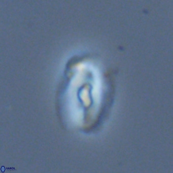 Helicosphaera neointermedia VR 05551