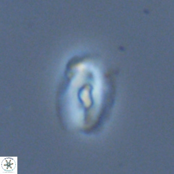 Helicosphaera neointermedia VR 05551
