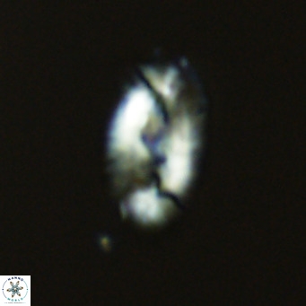 Helicosphaera neointermedia VR 05326