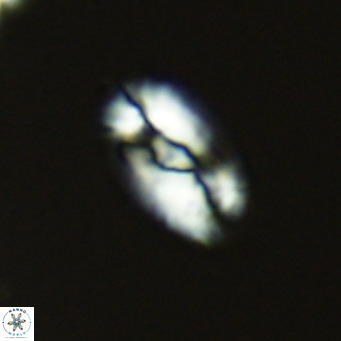 Helicosphaera neointermedia VR 05327